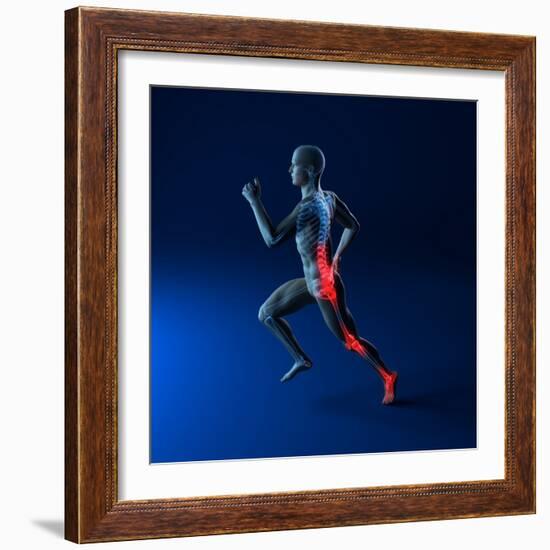 Running Injuries, Conceptual Artwork-SCIEPRO-Framed Premium Photographic Print