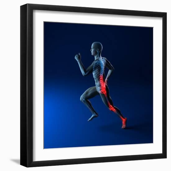 Running Injuries, Conceptual Artwork-SCIEPRO-Framed Premium Photographic Print