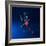 Running Injuries, Conceptual Artwork-SCIEPRO-Framed Premium Photographic Print