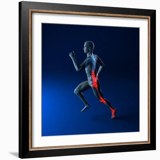 Running Injuries, Conceptual Artwork-SCIEPRO-Framed Premium Photographic Print