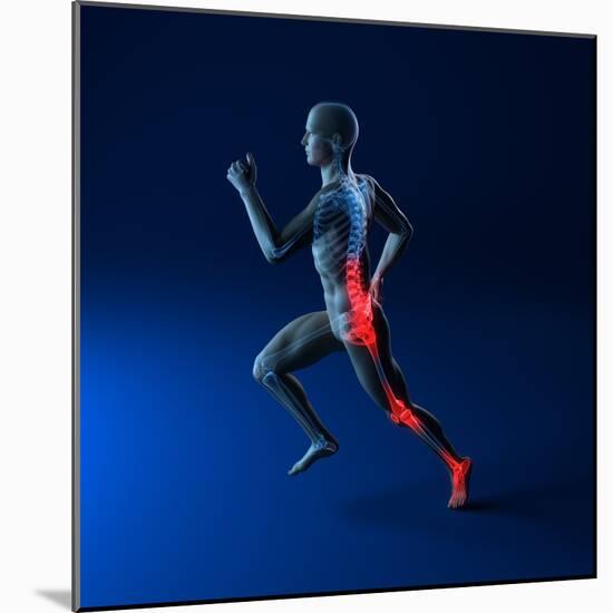 Running Injuries, Conceptual Artwork-SCIEPRO-Mounted Premium Photographic Print