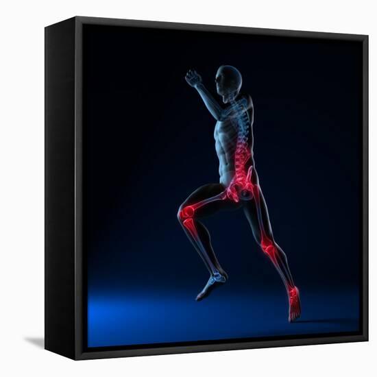 Running Injuries, Conceptual Artwork-SCIEPRO-Framed Premier Image Canvas