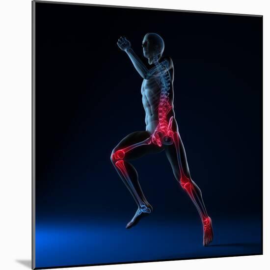 Running Injuries, Conceptual Artwork-SCIEPRO-Mounted Premium Photographic Print