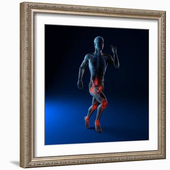 Running Injuries, Conceptual Artwork-SCIEPRO-Framed Premium Photographic Print