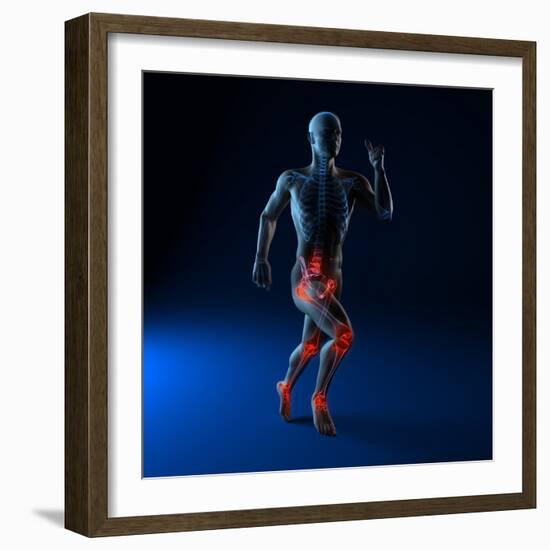 Running Injuries, Conceptual Artwork-SCIEPRO-Framed Premium Photographic Print