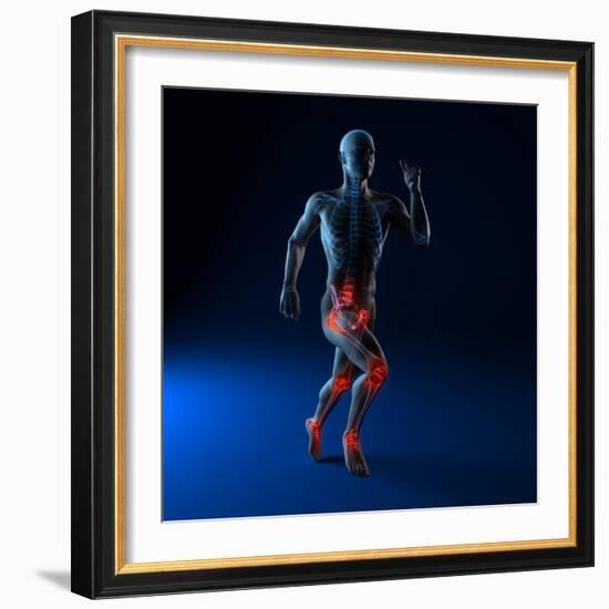 Running Injuries, Conceptual Artwork-SCIEPRO-Framed Premium Photographic Print