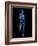 Running Skeleton, Artwork-SCIEPRO-Framed Photographic Print