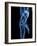 Running Skeleton, Artwork-SCIEPRO-Framed Photographic Print