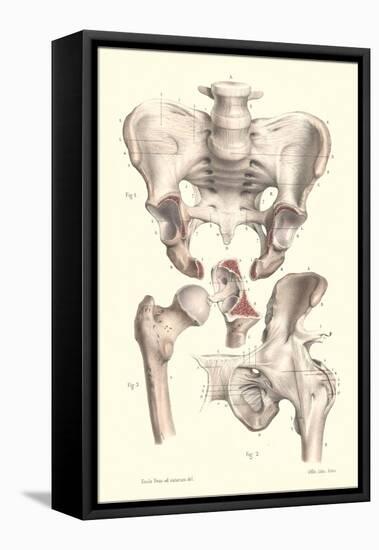 Sacroiliac Bones-null-Framed Stretched Canvas