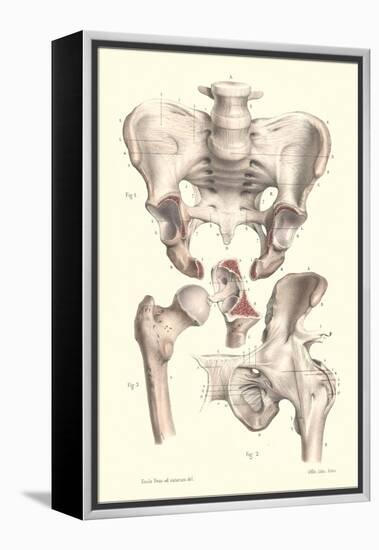 Sacroiliac Bones-null-Framed Stretched Canvas