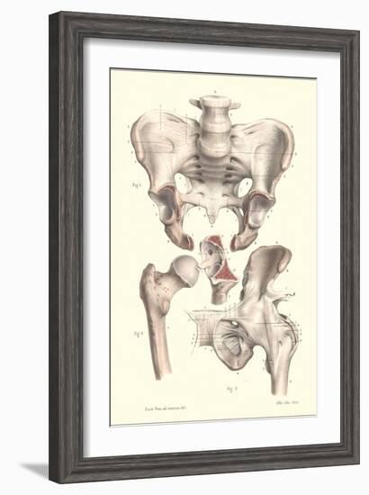 Sacroiliac Bones-null-Framed Art Print