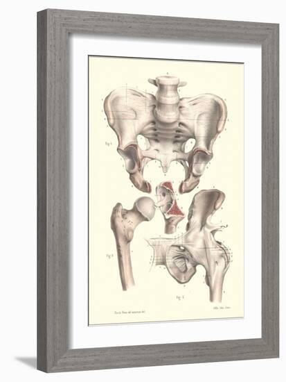 Sacroiliac Bones-null-Framed Art Print