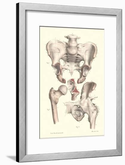 Sacroiliac Bones-null-Framed Art Print