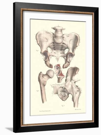 Sacroiliac Bones-null-Framed Art Print