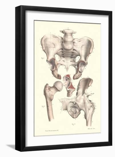 Sacroiliac Bones-null-Framed Art Print