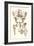 Sacroiliac Bones-null-Framed Art Print