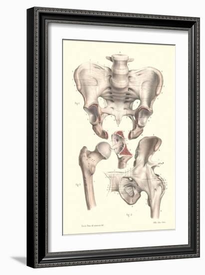 Sacroiliac Bones-null-Framed Art Print