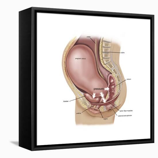 Sagittal View of Pregnant Uterus Showing Displaced Pelvic Organs-null-Framed Stretched Canvas