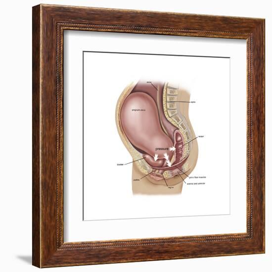 Sagittal View of Pregnant Uterus Showing Displaced Pelvic Organs-null-Framed Art Print