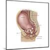 Sagittal View of Pregnant Uterus Showing Displaced Pelvic Organs-null-Mounted Art Print