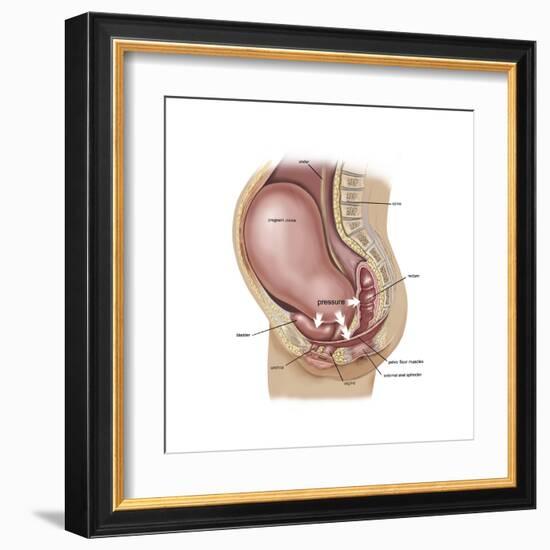 Sagittal View of Pregnant Uterus Showing Displaced Pelvic Organs-null-Framed Art Print