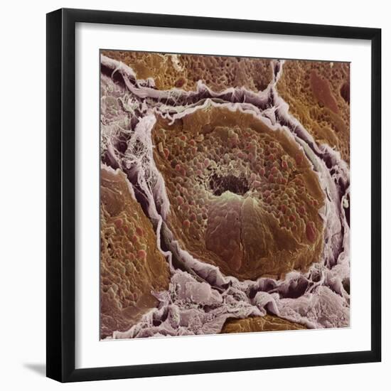 Salivary Gland-Steve Gschmeissner-Framed Premium Photographic Print