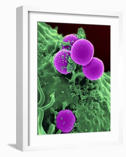 Scanning Electron Micrograph of a Human Neutrophil Ingesting Mrsa-Stocktrek Images-Framed Photographic Print