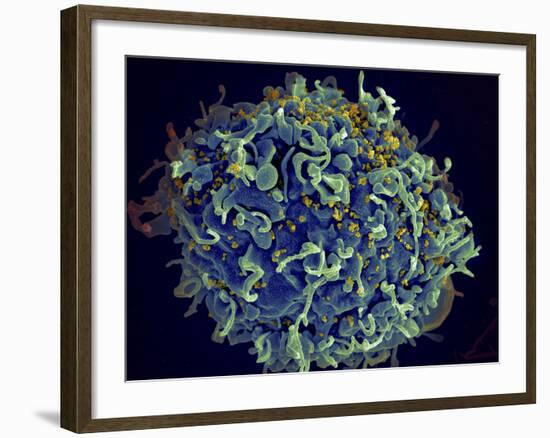 Scanning Electron Micrograph of Hiv Particles Infecting a Human H9 T Cell-Stocktrek Images-Framed Photographic Print