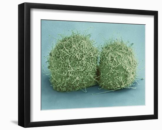 Scanning Electron Micrograph of Just-Divided Hela Cells-Stocktrek Images-Framed Photographic Print