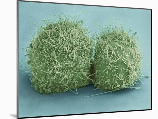 Scanning Electron Micrograph of Just-Divided Hela Cells-Stocktrek Images-Mounted Photographic Print