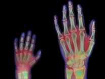 Adult And Child Hand X-rays-Science Photo Library-Photographic Print