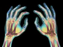 Coloured X-ray of Healthy Human Hands-Science Photo Library-Photographic Print