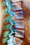 Neck Vertebrae Extended, X-ray-Science Photo Library-Photographic Print