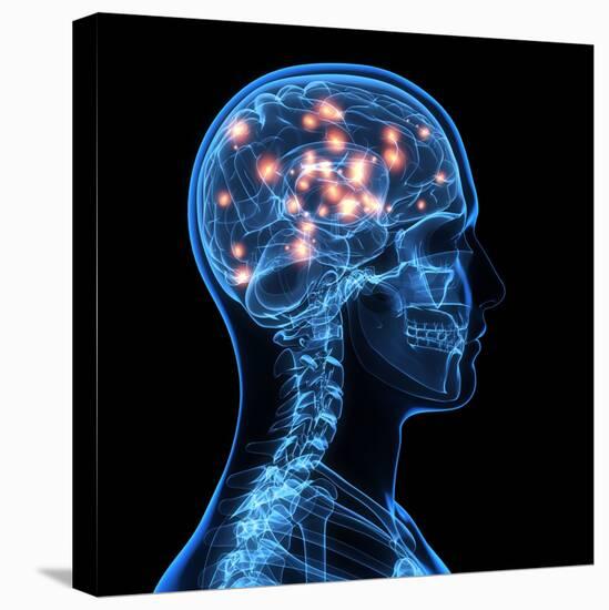 Stretched Canvas Print, , large