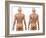 Scoliosis of the Spine, Artwork-SCIEPRO-Framed Photographic Print