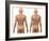 Scoliosis of the Spine, Artwork-SCIEPRO-Framed Photographic Print