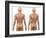 Scoliosis of the Spine, Artwork-SCIEPRO-Framed Photographic Print