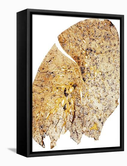 Section of Human Smoker's Lung Showing Tar-James Stevenson-Framed Premier Image Canvas