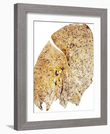 Section of Human Smoker's Lung Showing Tar-James Stevenson-Framed Photographic Print