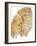 Section of Human Smoker's Lung Showing Tar-James Stevenson-Framed Photographic Print