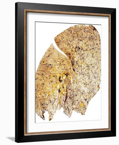 Section of Human Smoker's Lung Showing Tar-James Stevenson-Framed Photographic Print