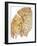 Section of Human Smoker's Lung Showing Tar-James Stevenson-Framed Photographic Print