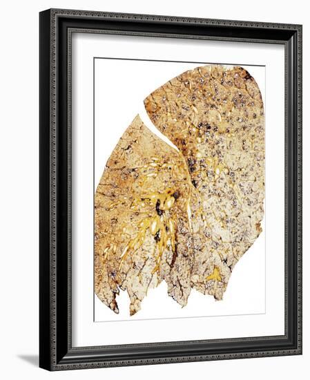 Section of Human Smoker's Lung Showing Tar-James Stevenson-Framed Photographic Print