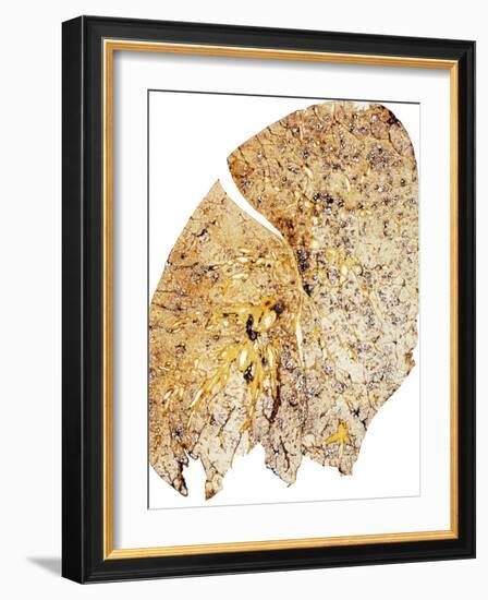 Section of Human Smoker's Lung Showing Tar-James Stevenson-Framed Photographic Print