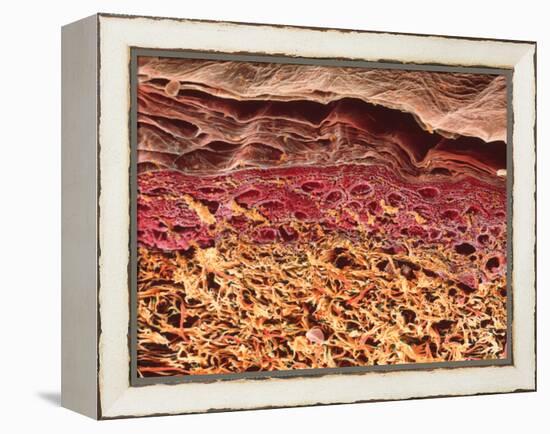 SEM of Section Through Human Skin-Steve Gschmeissner-Framed Premier Image Canvas