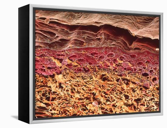 SEM of Section Through Human Skin-Steve Gschmeissner-Framed Premier Image Canvas