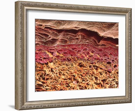 SEM of Section Through Human Skin-Steve Gschmeissner-Framed Photographic Print