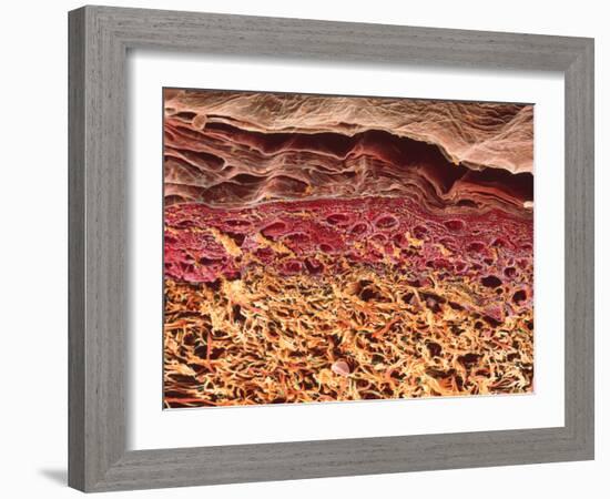 SEM of Section Through Human Skin-Steve Gschmeissner-Framed Photographic Print