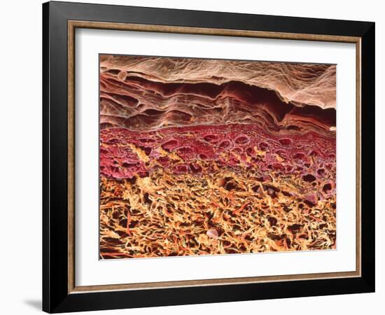 SEM of Section Through Human Skin-Steve Gschmeissner-Framed Photographic Print