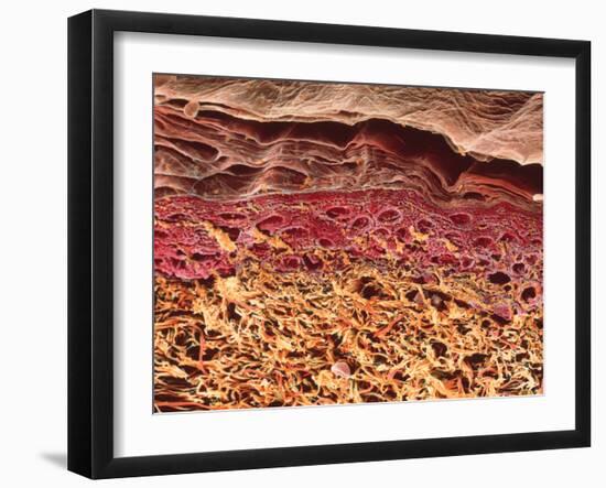 SEM of Section Through Human Skin-Steve Gschmeissner-Framed Photographic Print